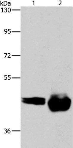 Polyclonal Rabbit anti-Human CD38 Antibody (IHC, WB)