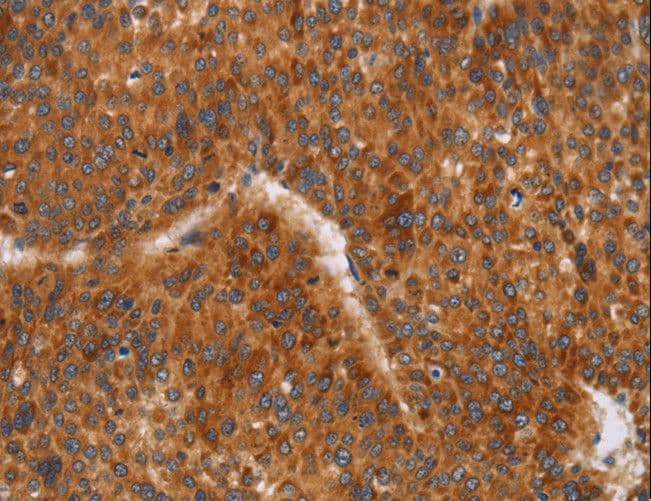 Polyclonal Rabbit anti-Human CD38 Antibody (IHC, WB)