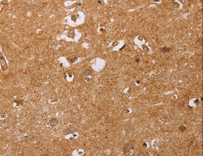 Polyclonal Rabbit anti-Human CD38 Antibody (IHC, WB)