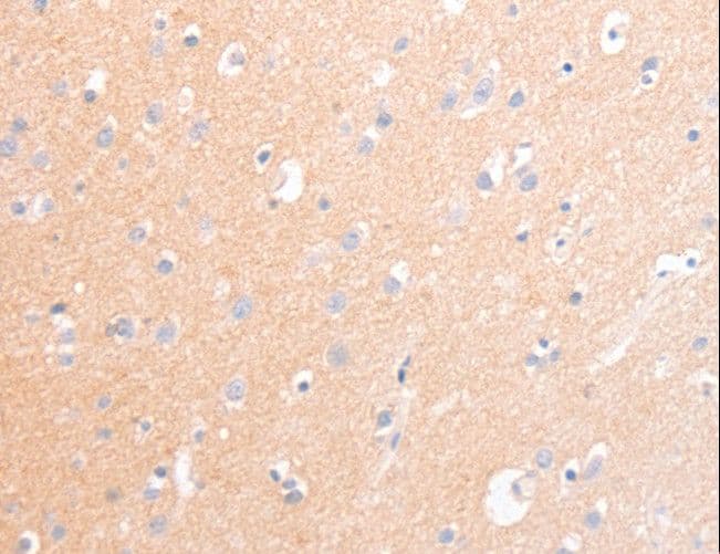 Polyclonal Rabbit anti-Human NCAM / CD56 Antibody (IHC)