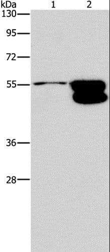 Polyclonal Rabbit anti-Human CRHR2 / CRF2 Receptor Antibody (IHC, WB)