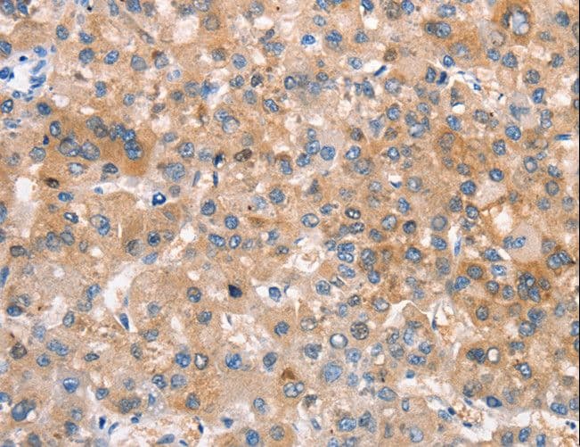 Polyclonal Rabbit anti-Human CRHR2 / CRF2 Receptor Antibody (IHC, WB)