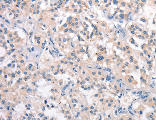 Polyclonal Rabbit anti-Human CRHR2 / CRF2 Receptor Antibody (IHC, WB)
