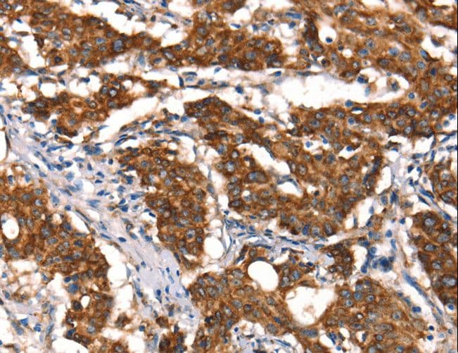 Polyclonal Rabbit anti-Human Cytochrome b Antibody (IHC)