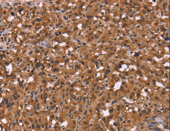 Polyclonal Rabbit anti-Human HDLBP / Vigilin Antibody (IHC, WB)