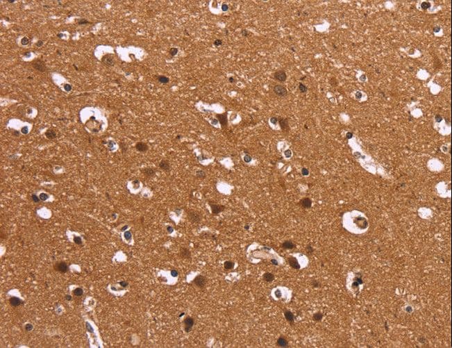 Polyclonal Rabbit anti-Human HDLBP / Vigilin Antibody (IHC, WB)