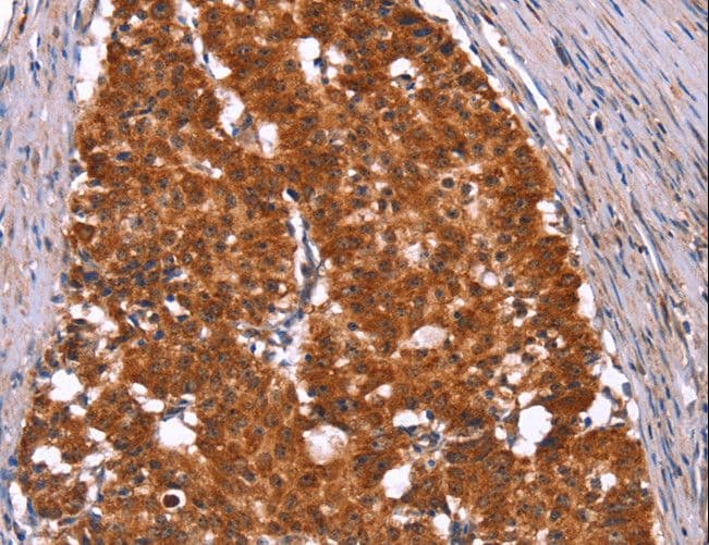 Polyclonal Rabbit anti-Human HINT / HINT1 Antibody (IHC, WB)