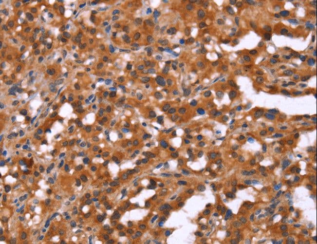 Polyclonal Rabbit anti-Human HINT / HINT1 Antibody (IHC, WB)