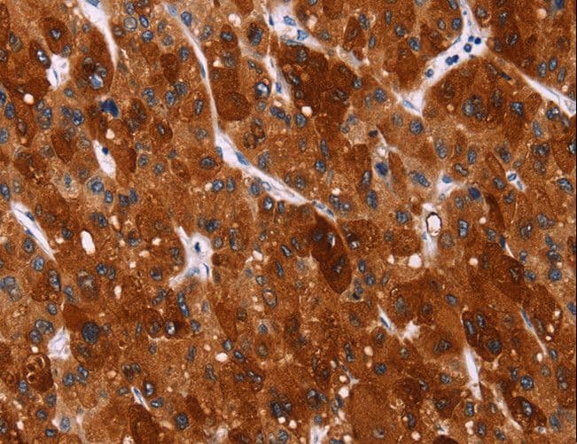 Polyclonal Rabbit anti-Human HSPB6 / HSP20 Antibody (IHC)