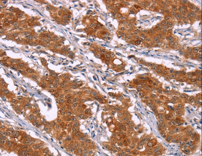Polyclonal Rabbit anti-Human HSPB6 / HSP20 Antibody (IHC)