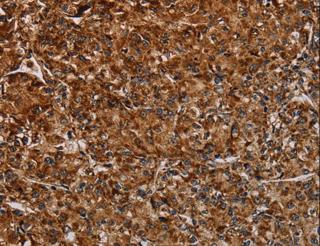 Polyclonal Rabbit anti-Human NDUFAB1 / ACP Antibody (IHC)