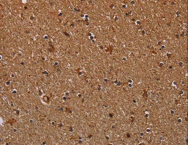 Polyclonal Rabbit anti-Human NDUFAB1 / ACP Antibody (IHC)
