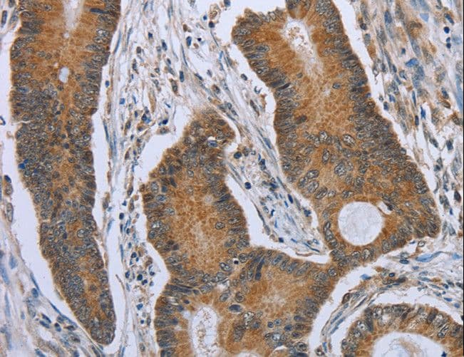 Polyclonal Rabbit anti-Human BAFF Receptor / CD268 Antibody (IHC)