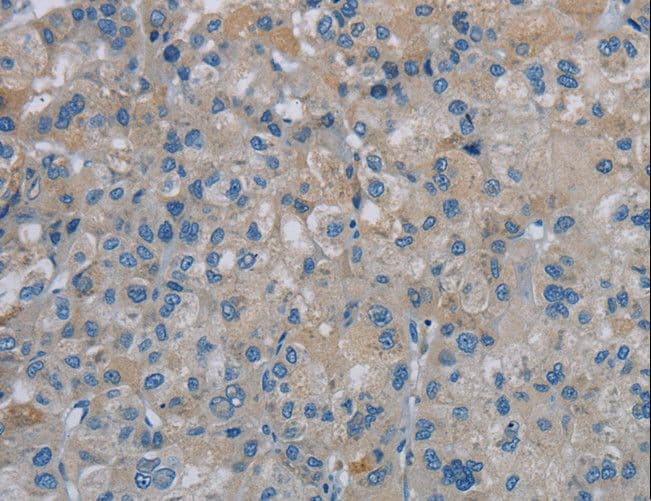 Polyclonal Rabbit anti-Human PGLYRP1 / PGRP Antibody (IHC)