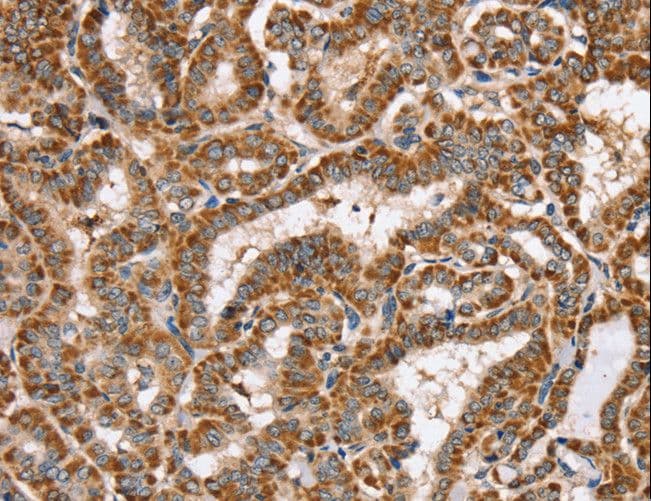 Polyclonal Rabbit anti-Human PPOX Antibody (IHC, WB)