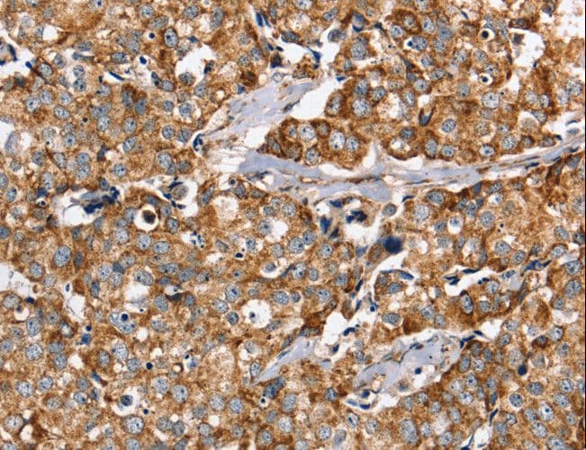 Polyclonal Rabbit anti-Human PPOX Antibody (IHC, WB)