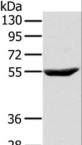 Polyclonal Rabbit anti-Human CYTH1 / Cytohesin-1 Antibody (IHC, WB)