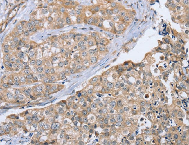Polyclonal Rabbit anti-Human CYTH1 / Cytohesin-1 Antibody (IHC, WB)