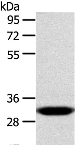 Polyclonal Rabbit anti-Human CCS Antibody (IHC, WB)