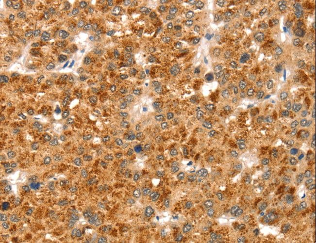 Polyclonal Rabbit anti-Human CCS Antibody (IHC, WB)