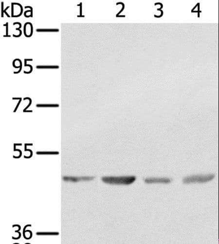 Polyclonal Rabbit anti-Human SSB / La Antibody (IHC, WB)