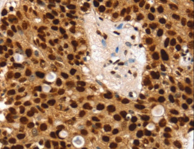 Polyclonal Rabbit anti-Human SSB / La Antibody (IHC, WB)
