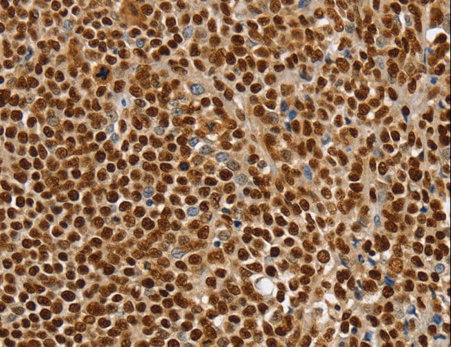 Polyclonal Rabbit anti-Human SSB / La Antibody (IHC, WB)