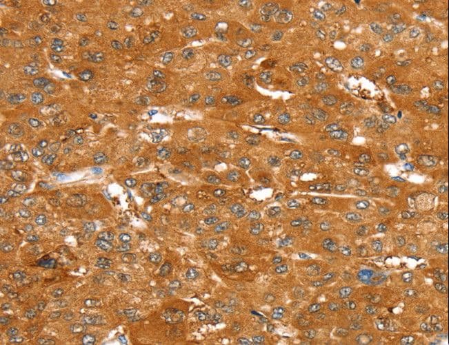 Polyclonal Rabbit anti-Human SUR2 / ABCC9 Antibody (IHC)