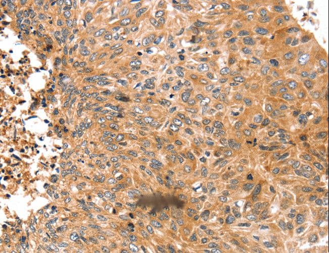 Polyclonal Rabbit anti-Human SUR2 / ABCC9 Antibody (IHC)