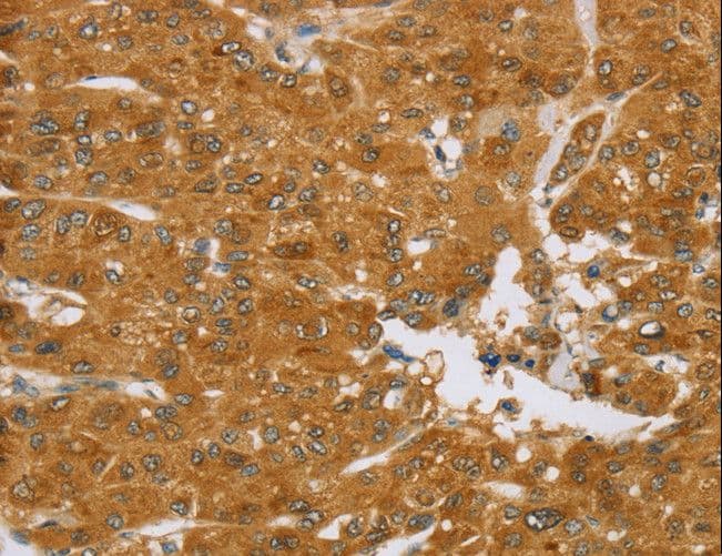 Polyclonal Rabbit anti-Human TNFSF13 / APRIL Antibody (IHC)