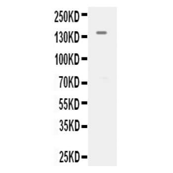 KDR / VEGFR2 / FLK1 Antibody (aa29-60)