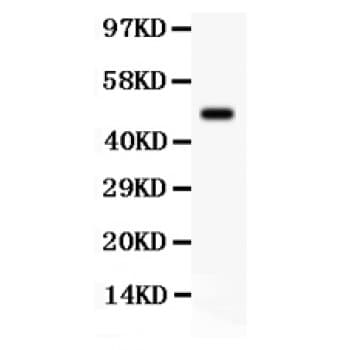 Polyclonal Rabbit anti-Human SGK1 / SGK Antibody (aa28-55, WB)