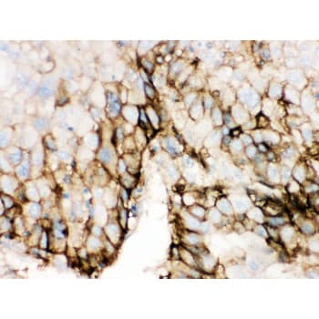 Polyclonal Rabbit anti-Human SLC2A2 / GLUT2 Antibody (aa486-514, IHC, WB)
