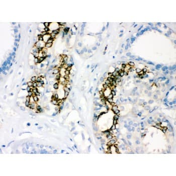 SOD2 / Mn SOD Antibody (aa192-222)