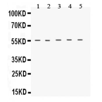 Polyclonal Rabbit anti-Human TACR1 / NK1R Antibody (aa264-291, WB)