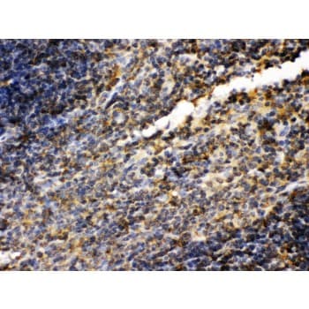 TGM2 / Transglutaminase 2 Antibody (aa7-34)