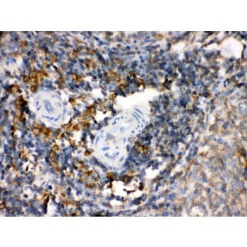 TGM2 / Transglutaminase 2 Antibody (aa7-34)