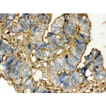 TGM2 / Transglutaminase 2 Antibody (aa7-34)