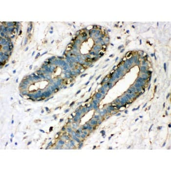 TGM2 / Transglutaminase 2 Antibody (aa7-34)