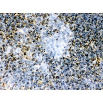 TGM2 / Transglutaminase 2 Antibody (aa7-34)