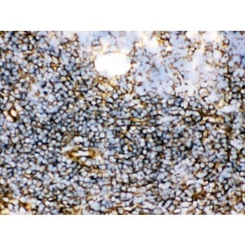 TGM2 / Transglutaminase 2 Antibody (aa7-34)
