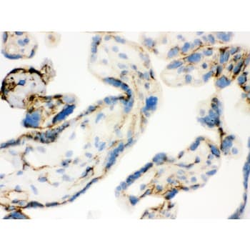 TGM2 / Transglutaminase 2 Antibody (aa7-34)