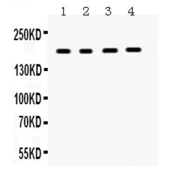 Polyclonal Rabbit anti-Human THBS1 / Thrombospondin-1 Antibody (aa58-86, WB)