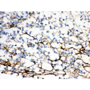 Polyclonal Rabbit anti-Human VCAN / Versican Antibody (aa65-92, IHC, WB)