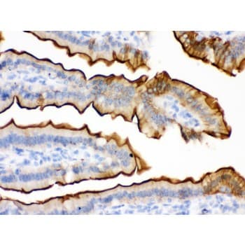 Polyclonal Rabbit anti-Human VIL1 / Villin Antibody (aa770-799, IHC, WB)