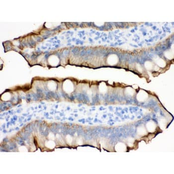 Polyclonal Rabbit anti-Human VIL1 / Villin Antibody (aa770-799, IHC, WB)