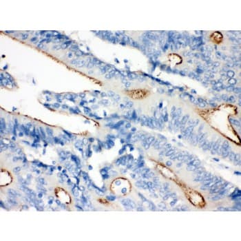 Polyclonal Rabbit anti-Human VIL1 / Villin Antibody (aa770-799, IHC, WB)