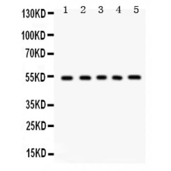 Polyclonal Rabbit anti-Human VTN / Vitronectin Antibody (aa446-472, IHC, WB)