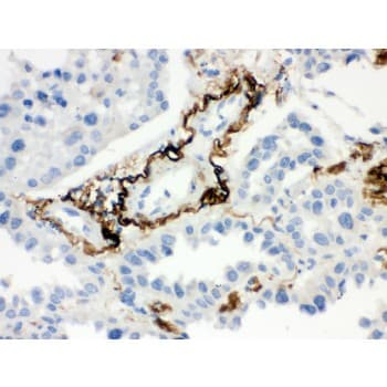 Polyclonal Rabbit anti-Human VTN / Vitronectin Antibody (aa446-472, IHC, WB)