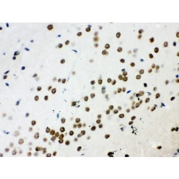 Polyclonal Rabbit anti-Human WNT2B Antibody (aa87-112, IHC, WB)